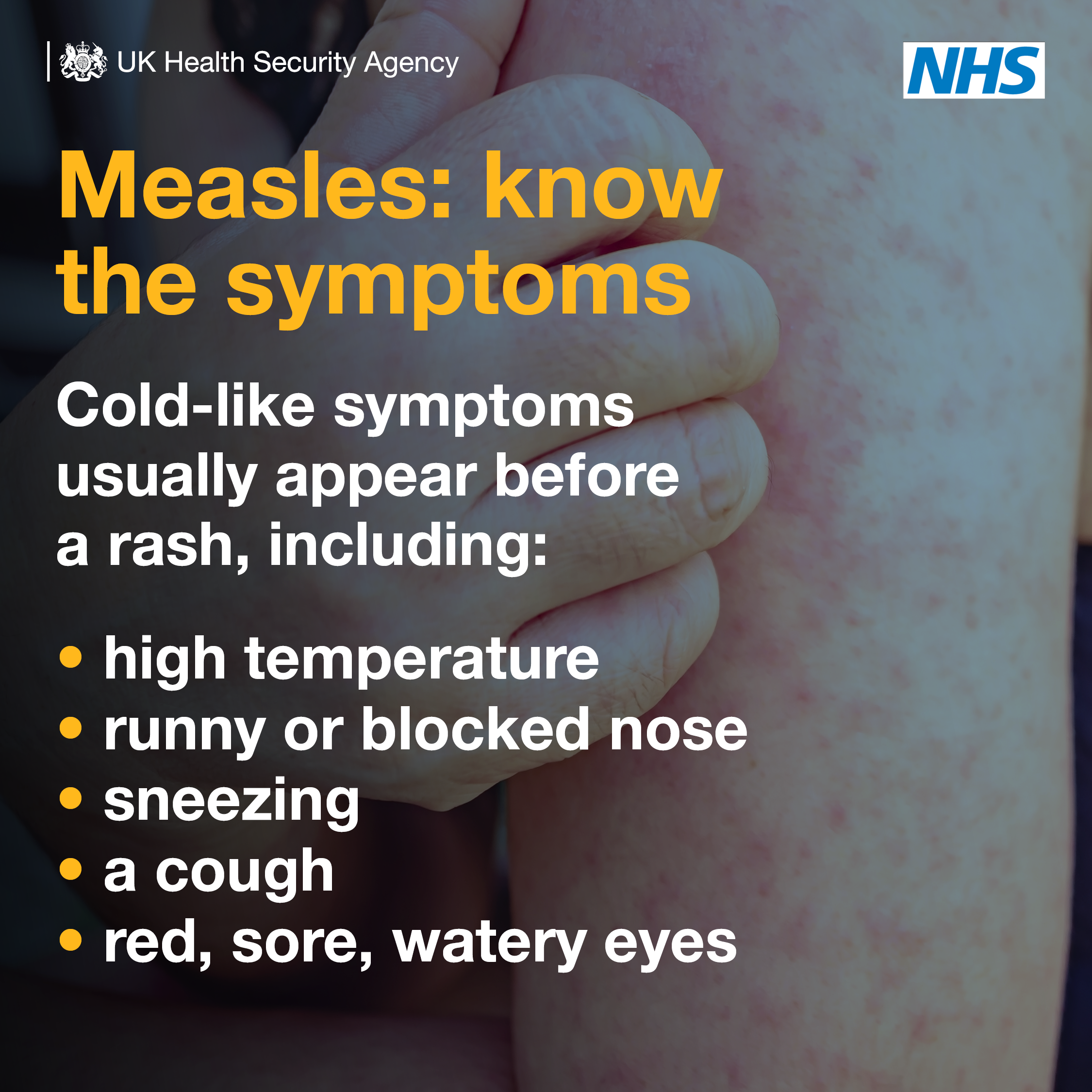Measles Symptoms 1 Banner